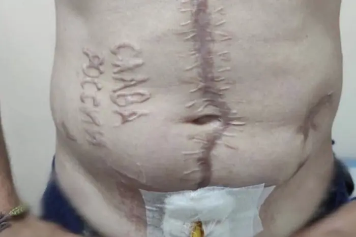 The branding 'Glory to Russia' burned on the body of a defender. Ukraine confirmed the authenticity of the photo
